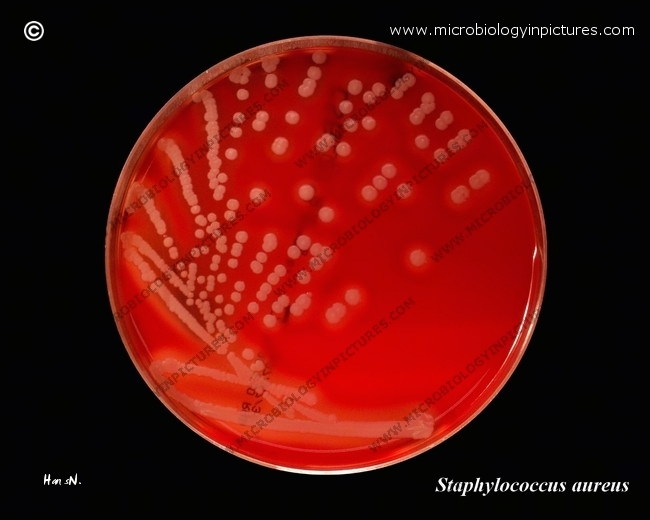 s.aureus translucent light